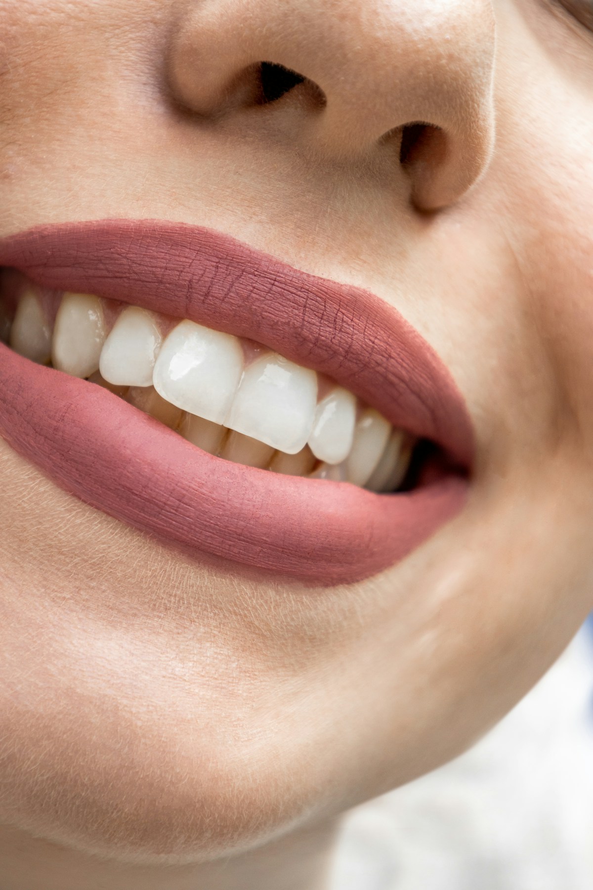 Sorriso em close com dentes claros