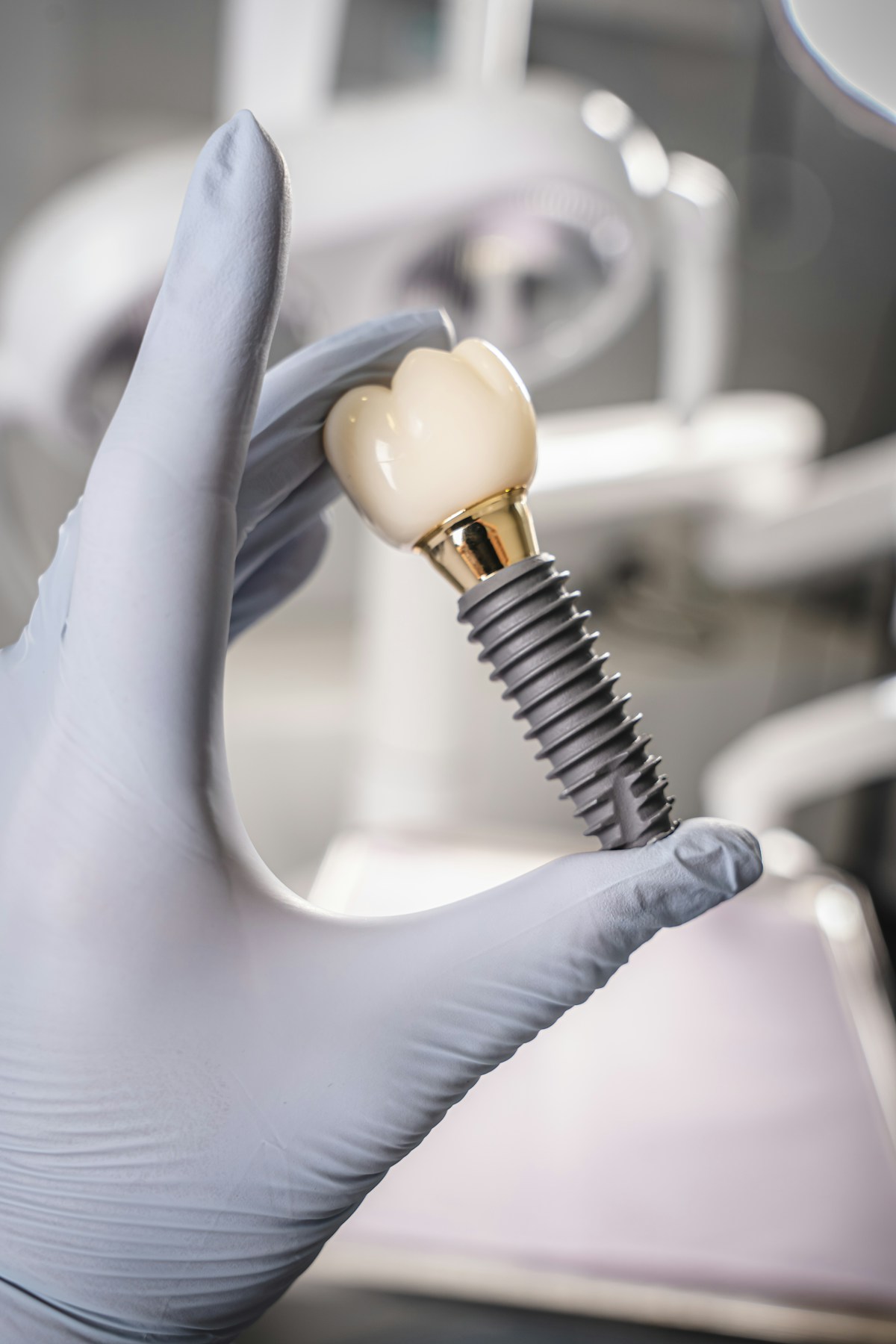 Modelo de implante dentário com coroa