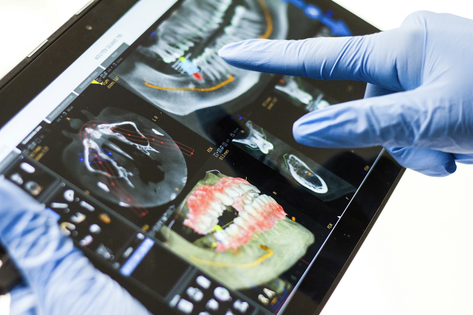 Dentista mostrando exame digital em um tablet