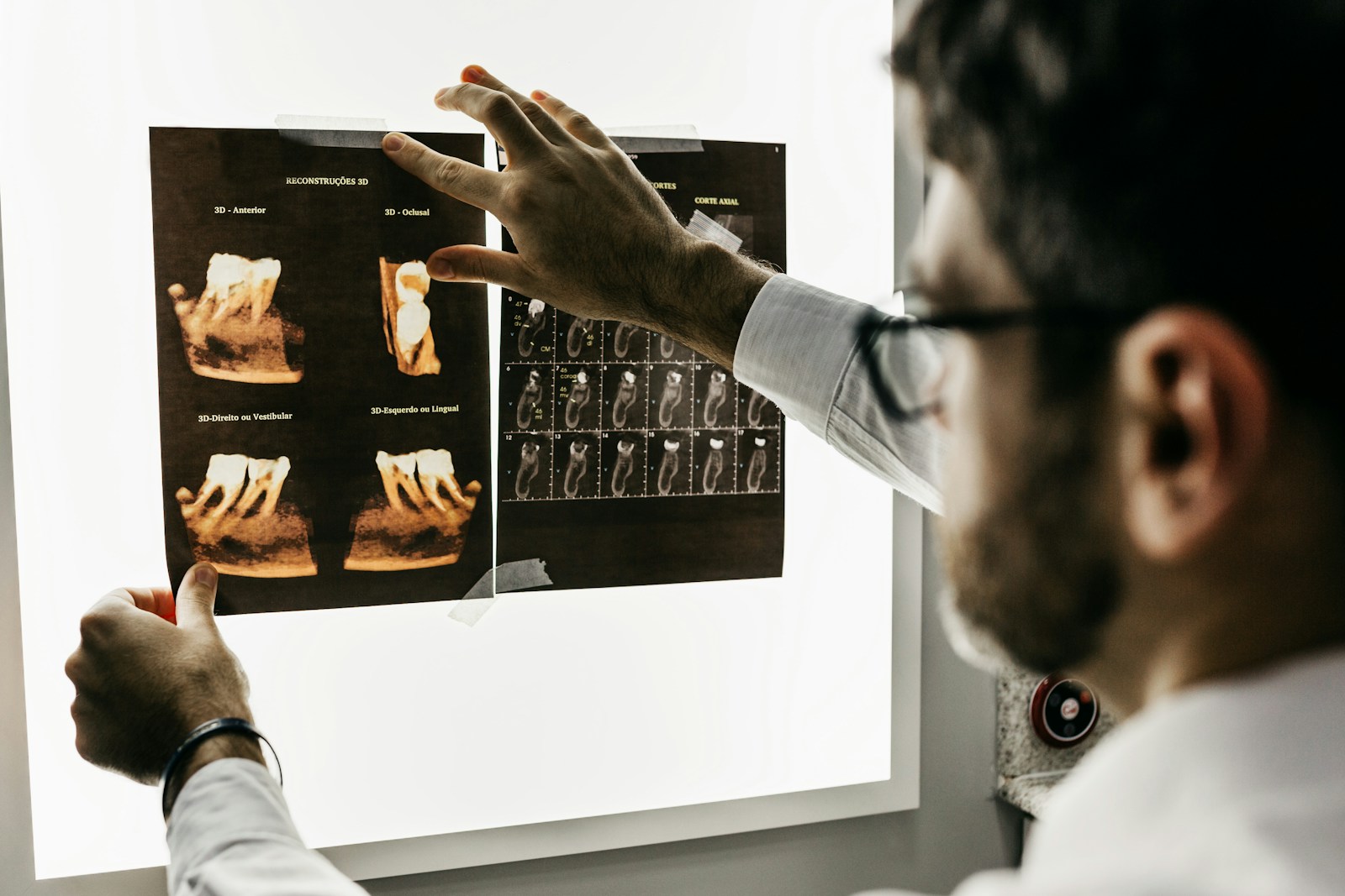 Dentista analisando radiografias dos dentes